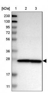 Anti-NUP35 antibody produced in rabbit HPA018401-100UL