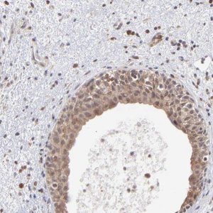 Anti-OAS1 antibody produced in rabbit 