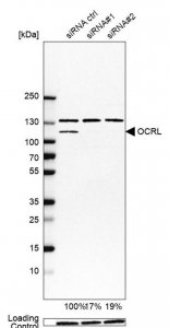 Anti-OCRL antibody produced in rabbit 