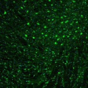 Anti-OGFOD1 antibody produced in rabbit 
