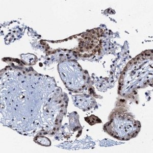 Anti-OLAH antibody produced in rabbit 