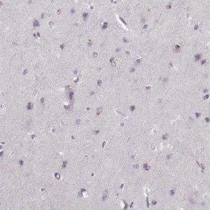 Anti-OPRD1 antibody produced in rabbit 