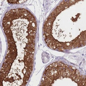 Anti-OR11H1 antibody produced in rabbit 