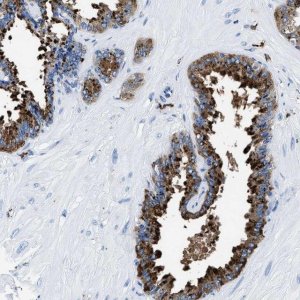 Anti-OR14K1 antibody produced in rabbit 