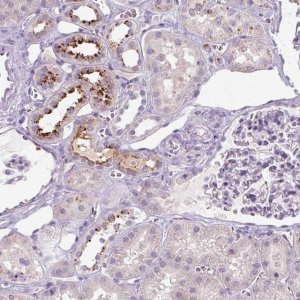 Anti-OR2AK2 antibody produced in rabbit 