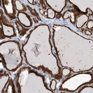 Anti-OR4K1 antibody produced in rabbit 