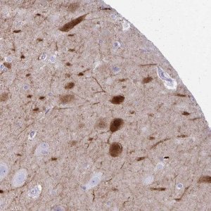 Anti-OR4M2 antibody produced in rabbit 