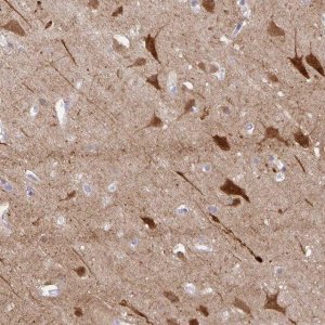 Anti-OR4N4 antibody produced in rabbit 
