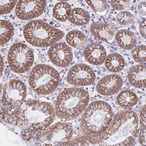 Anti-OR51M1 antibody produced in rabbit 