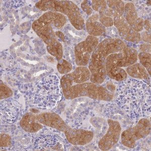Anti-OR5T1 antibody produced in rabbit 