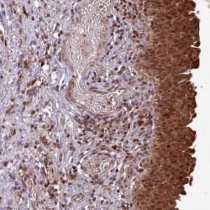 Anti-OR6B1 antibody produced in rabbit 
