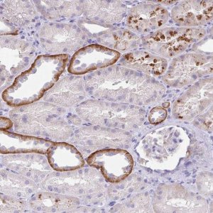 Anti-OR6N2 antibody produced in rabbit 