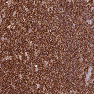 Anti-OR6P1 antibody produced in rabbit 