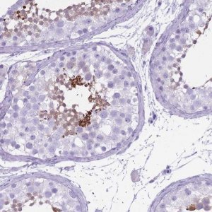 Anti-OR7C1 antibody produced in rabbit 