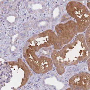 Anti-OR7C2 antibody produced in rabbit 