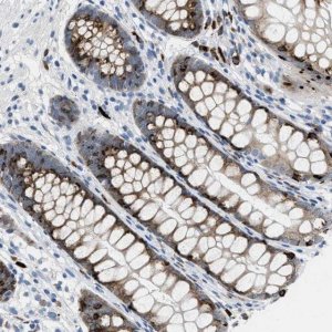 Anti-OR9K2 antibody produced in rabbit 