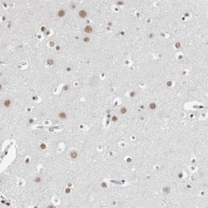 Anti-ORC1 antibody produced in rabbit 