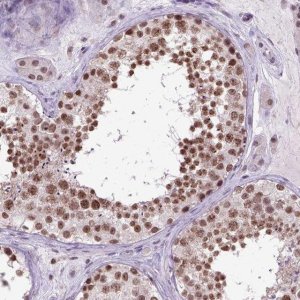 Anti-ORC5 antibody produced in rabbit 