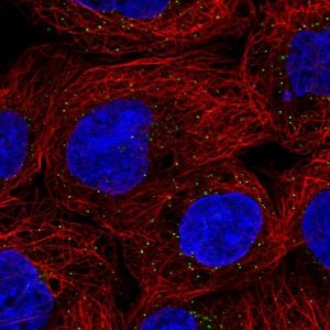 Anti-ORM1 antibody produced in rabbit 