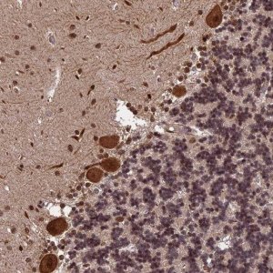Anti-OSBPL1A antibody produced in rabbit 