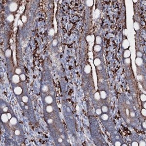Anti-OSBPL2 antibody produced in rabbit 