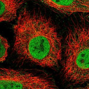 Anti-OSBPL7 antibody produced in rabbit HPA053083-100UL