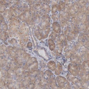 Anti-OSBPL8 antibody produced in rabbit 