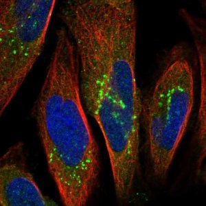 Anti-OSBPL9 antibody produced in rabbit 
