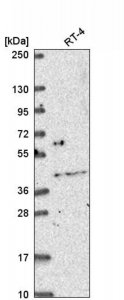 Anti-OSR2 antibody produced in rabbit 