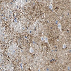 Anti-OTOF antibody produced in rabbit 