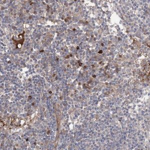 Anti-OTUD1 antibody produced in rabbit 
