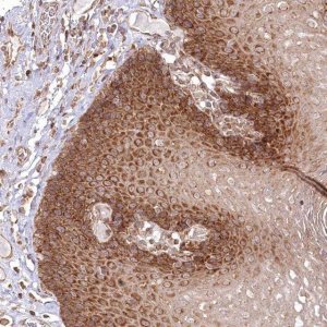 Anti-OTUD4 antibody produced in rabbit 