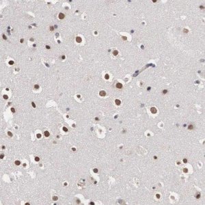 Anti-OTX2 antibody produced in rabbit 