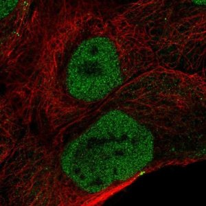 Anti-OVCA2 antibody produced in rabbit 
