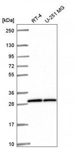 Anti-OVCA2 antibody produced in rabbit 