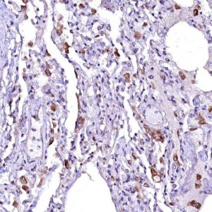 Anti-OVCH1 antibody produced in rabbit 