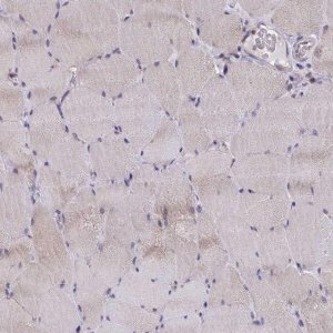 Anti-P2RX3 antibody produced in rabbit 