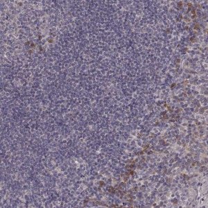 Anti-P2RX5 antibody produced in rabbit 