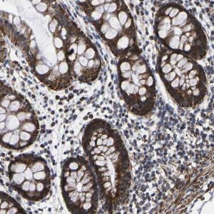 Anti-P2RY11 antibody produced in rabbit 