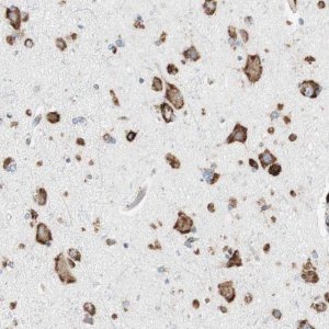 Anti-P4HTM antibody produced in rabbit HPA007199-100UL