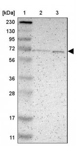 Anti-P4HTM antibody produced in rabbit HPA007199-100UL
