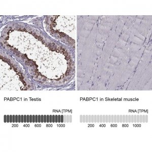 Anti-PABPC1 antibody produced in rabbit 