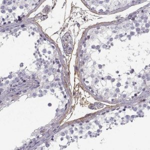 Anti-PABPC1L2A antibody produced in rabbit 