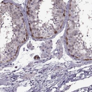 Anti-PAGE2B antibody produced in rabbit 
