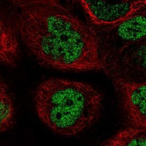 Anti-PALB2 antibody produced in rabbit 