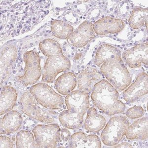 Anti-PALM3 antibody produced in rabbit 