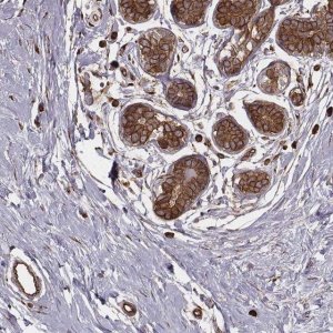 Anti-PALMD antibody produced in rabbit 