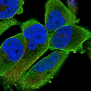 Anti-PALMD antibody produced in rabbit 