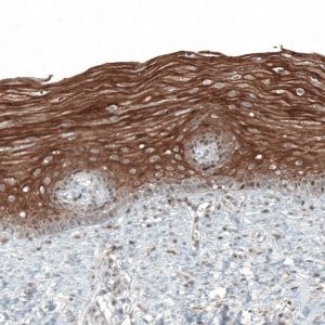 Anti-PAPD5 antibody produced in rabbit 