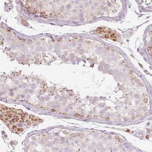 Anti-PAQR9 antibody produced in rabbit 